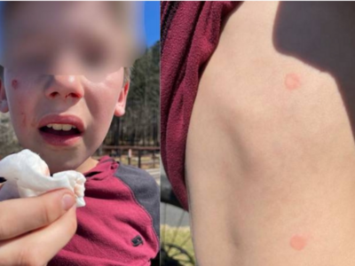 Two 14-Year-Old Boys Arrested After Injuring Kids: Police